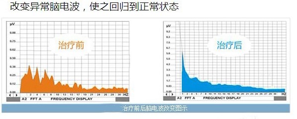 查明精神分裂病因 及时治疗效果好